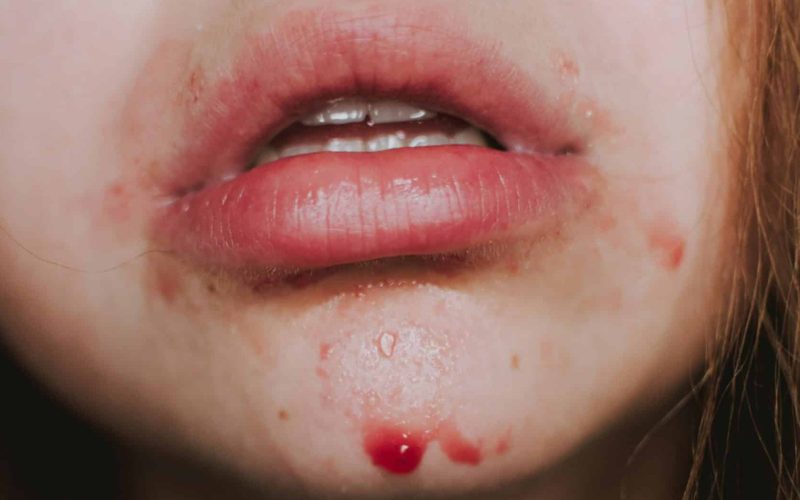 lilartsy-fiL7_6xvSrY-unsplash