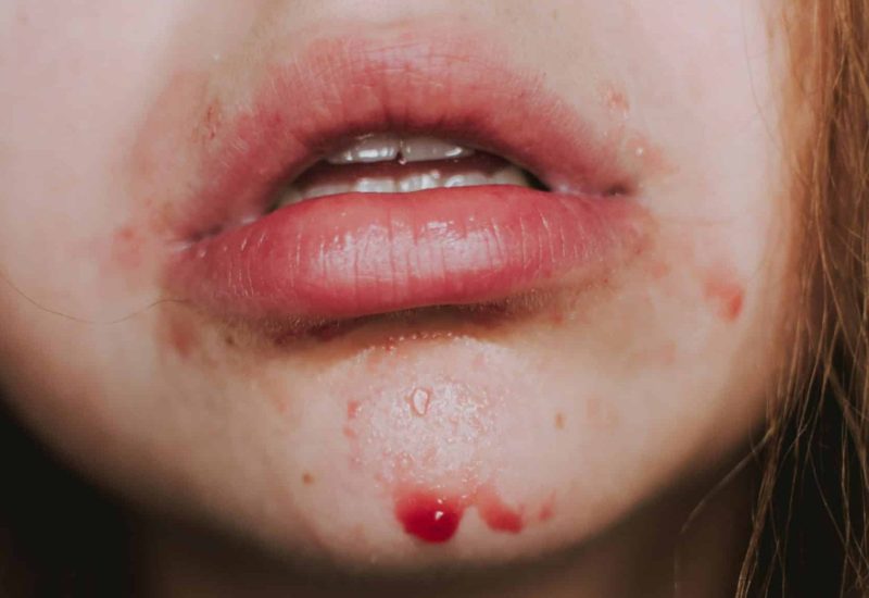 lilartsy-fiL7_6xvSrY-unsplash